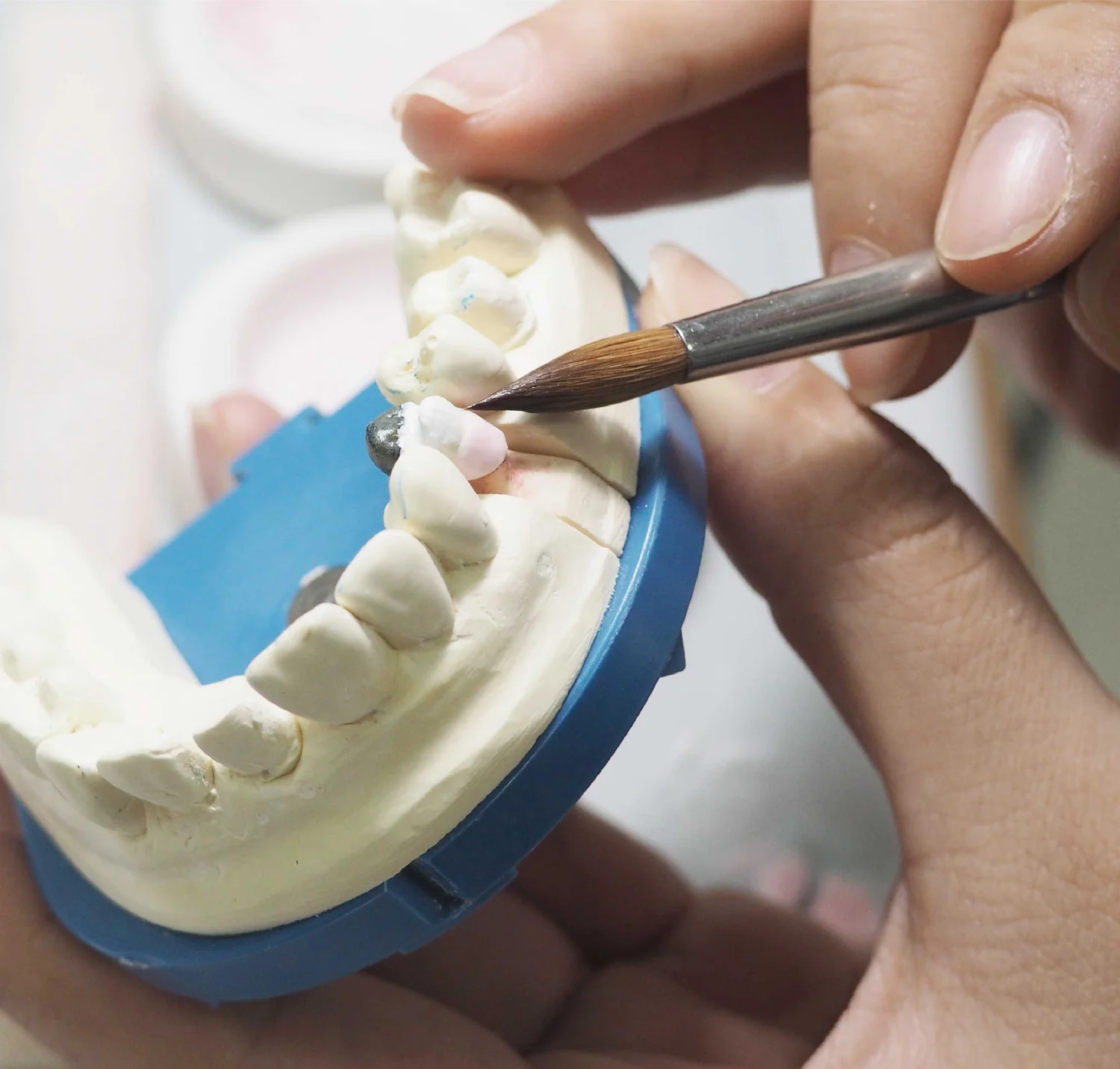 Hand finishing a dental restoration